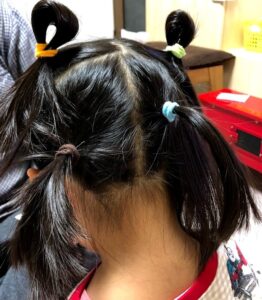 アタマジラミ対処方法